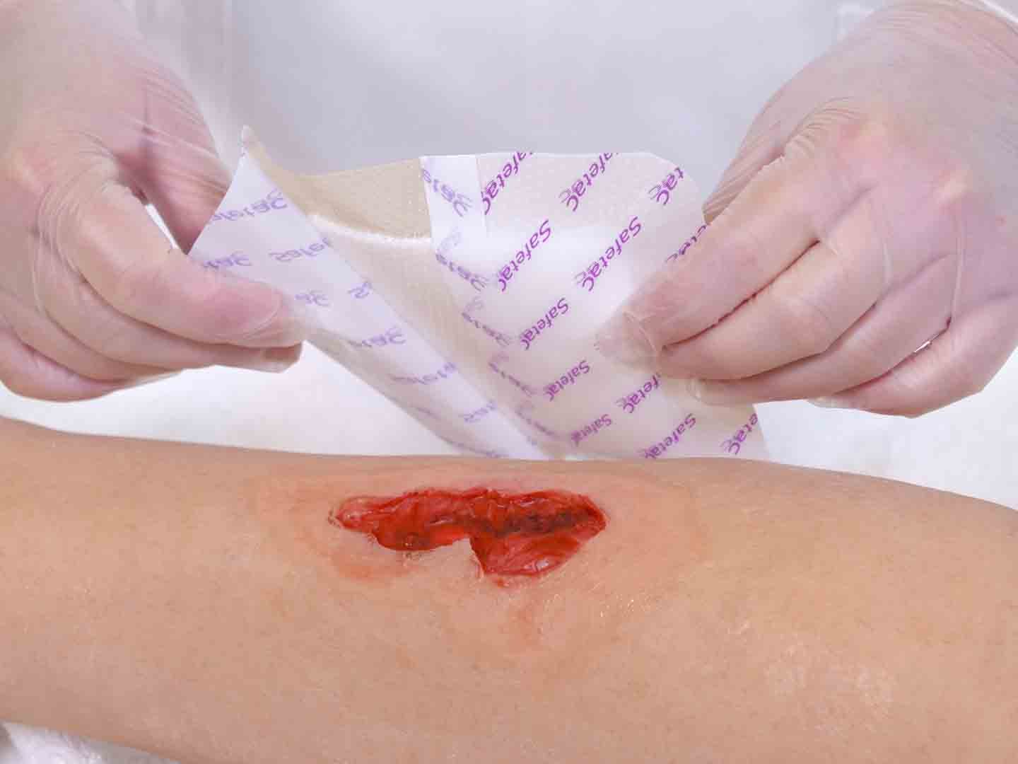 La disinfezione delle ferite: quale antisettico scegliere?