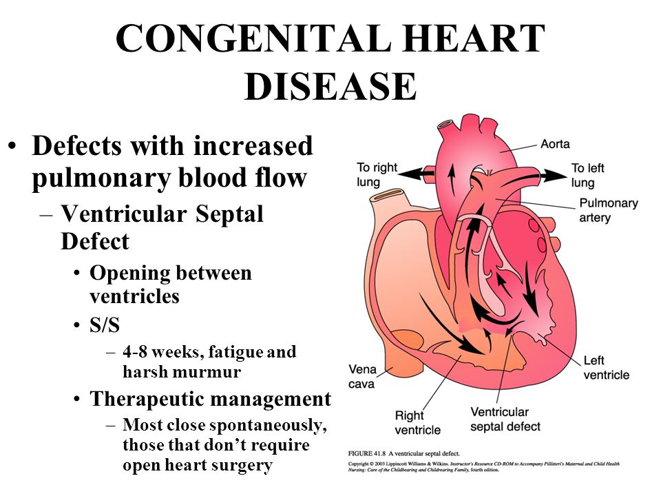 L'assistenza infermieristica nelle cardiopatie congenite. Un Infermiere del S.Orsola di Bologna tra gli autori del libro