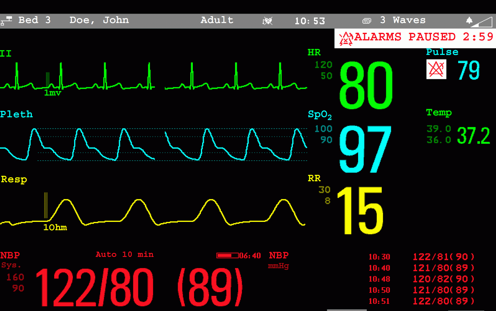 does iv labetalol affect heart rate